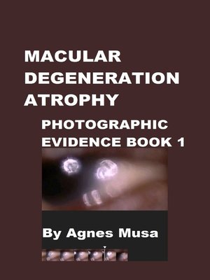 cover image of Macular Degeneration Atrophy, Photographic Evidence Book 1